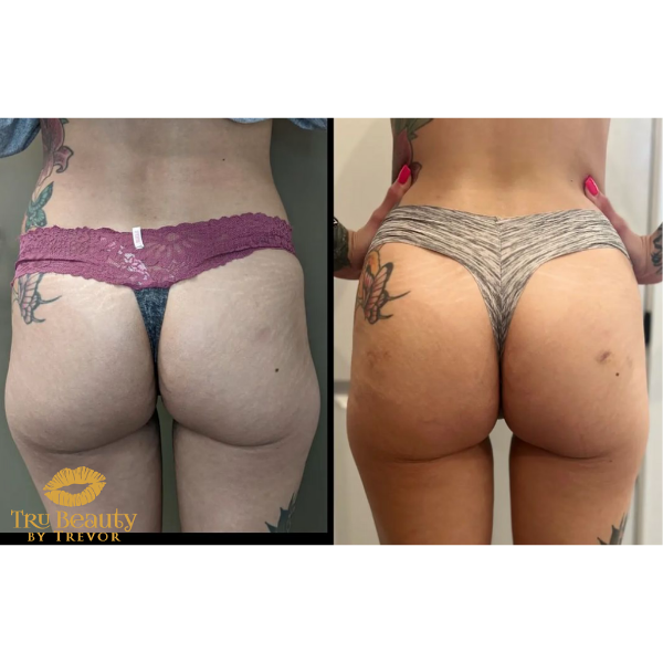 Trubeautybytrevor_Gallery_BOOTY_Before_and_After_Image_Four_IN_HENDERSON_NV