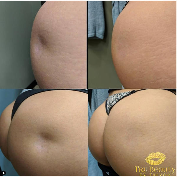 Trubeautybytrevor_Gallery_BOOTY_Before_and_After_Image_Two_IN_HENDERSON_NV