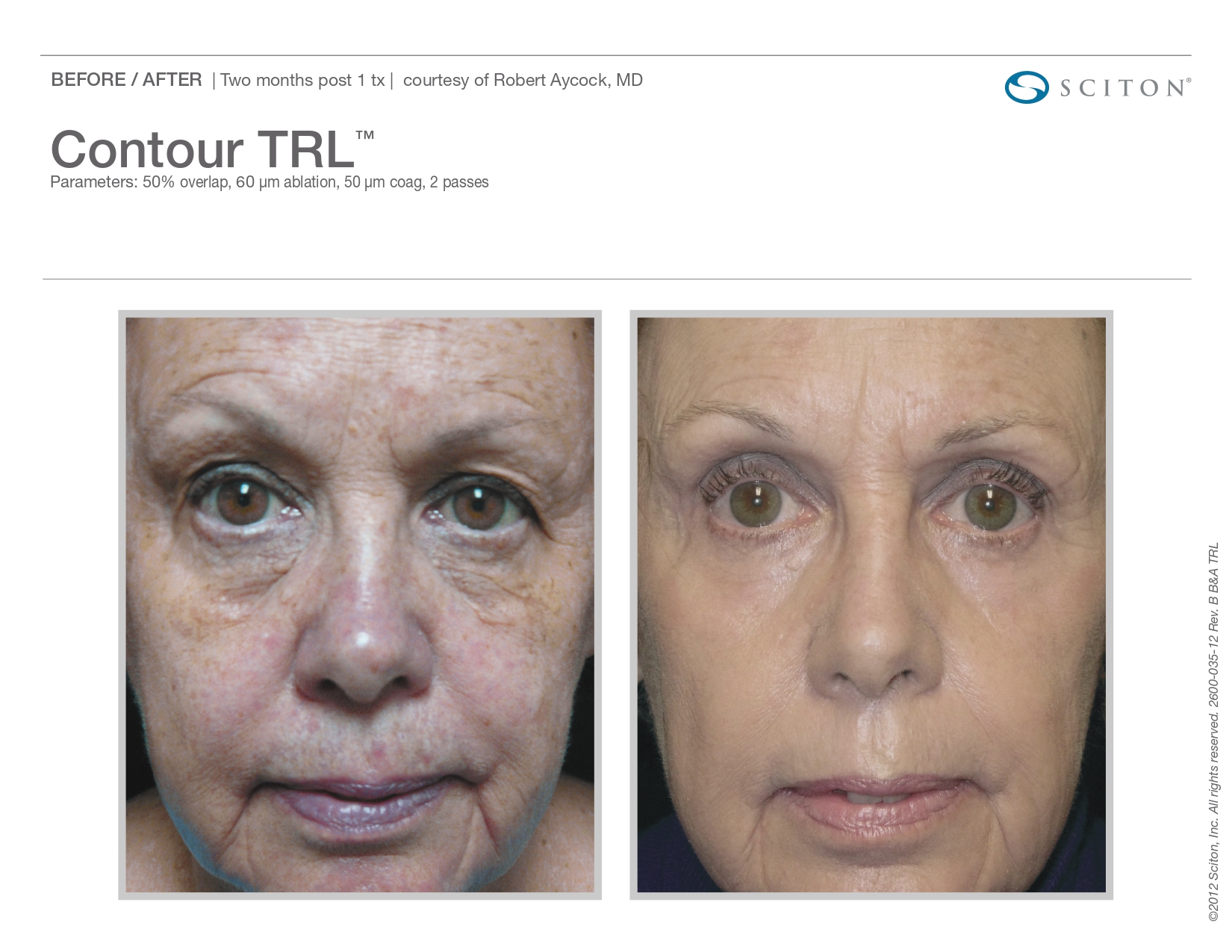 Trubeautybytrevor_Gallery_Image_CONTOUR_TRL_Before_and_After_Eight_IN_HENDERSON_NV