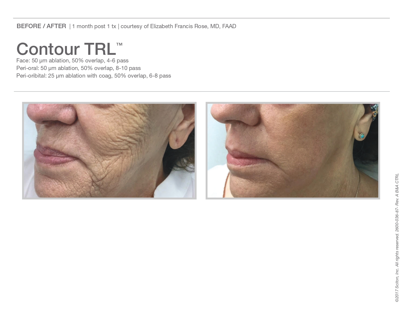 Trubeautybytrevor_Gallery_Image_CONTOUR_TRL_Before_and_After_Five_IN_HENDERSON_NV