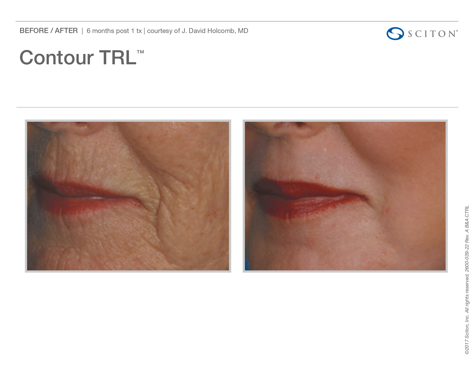 Trubeautybytrevor_Gallery_Image_CONTOUR_TRL_Before_and_After_Four_IN_HENDERSON_NV