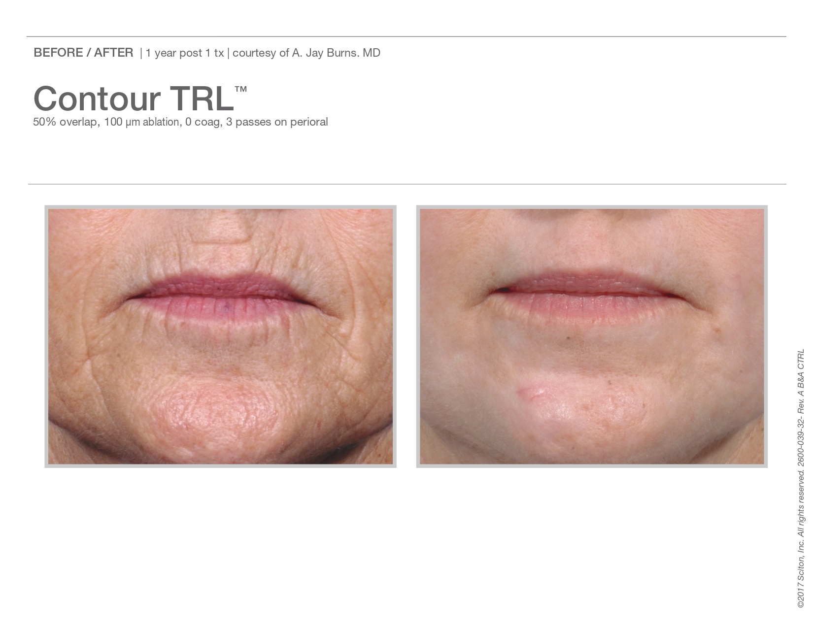 Trubeautybytrevor_Gallery_Image_CONTOUR_TRL_Before_and_After_Second_IN_HENDERSON_NV