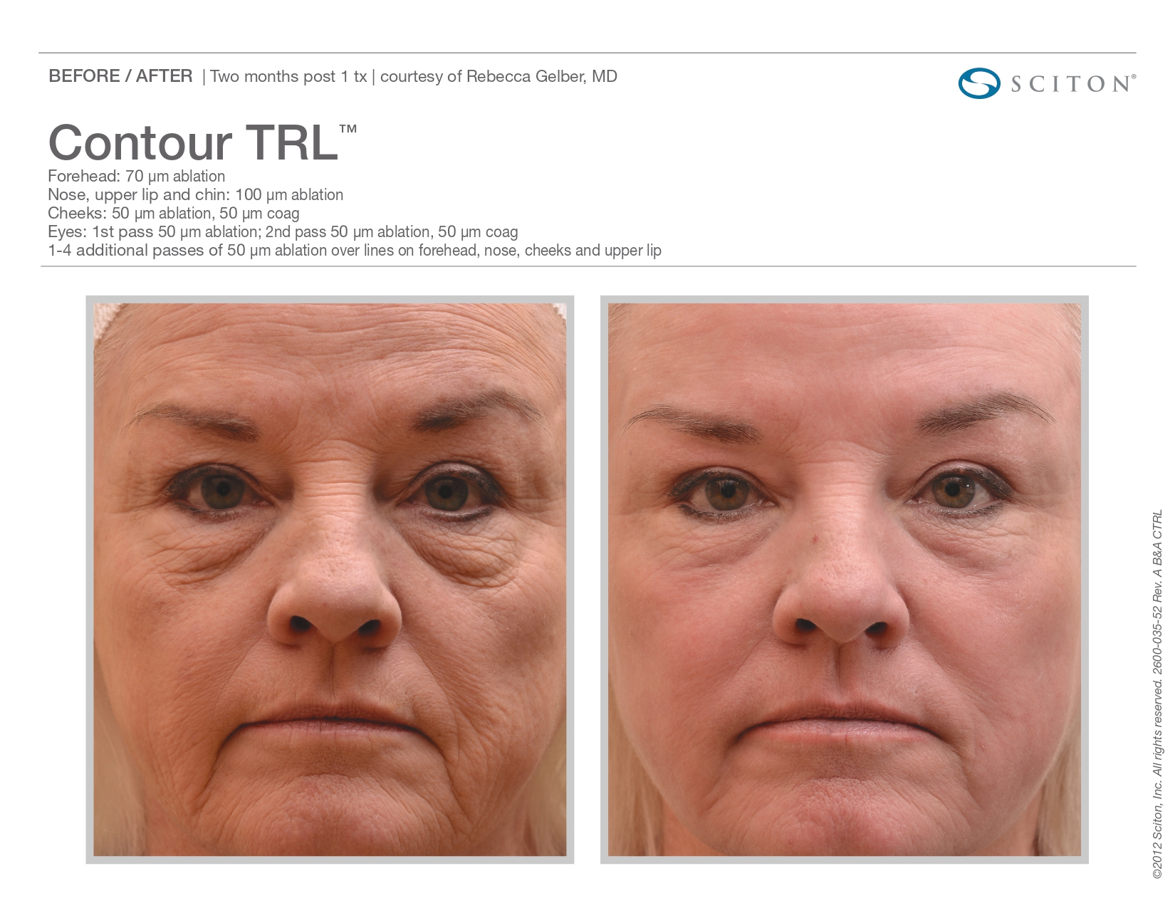 Trubeautybytrevor_Gallery_Image_CONTOUR_TRL_Before_and_After_Seven_IN_HENDERSON_NV