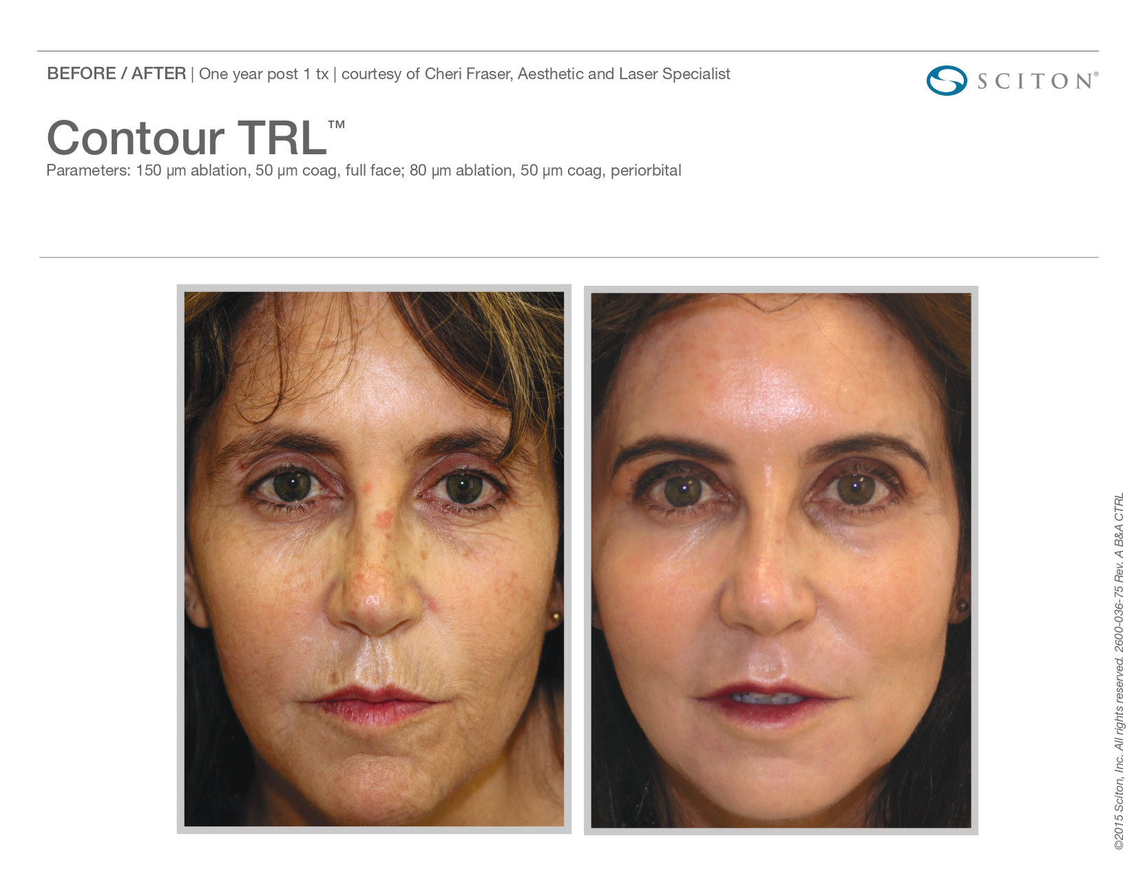 Trubeautybytrevor_Gallery_Image_CONTOUR_TRL_Before_and_After_Six_IN_HENDERSON_NV
