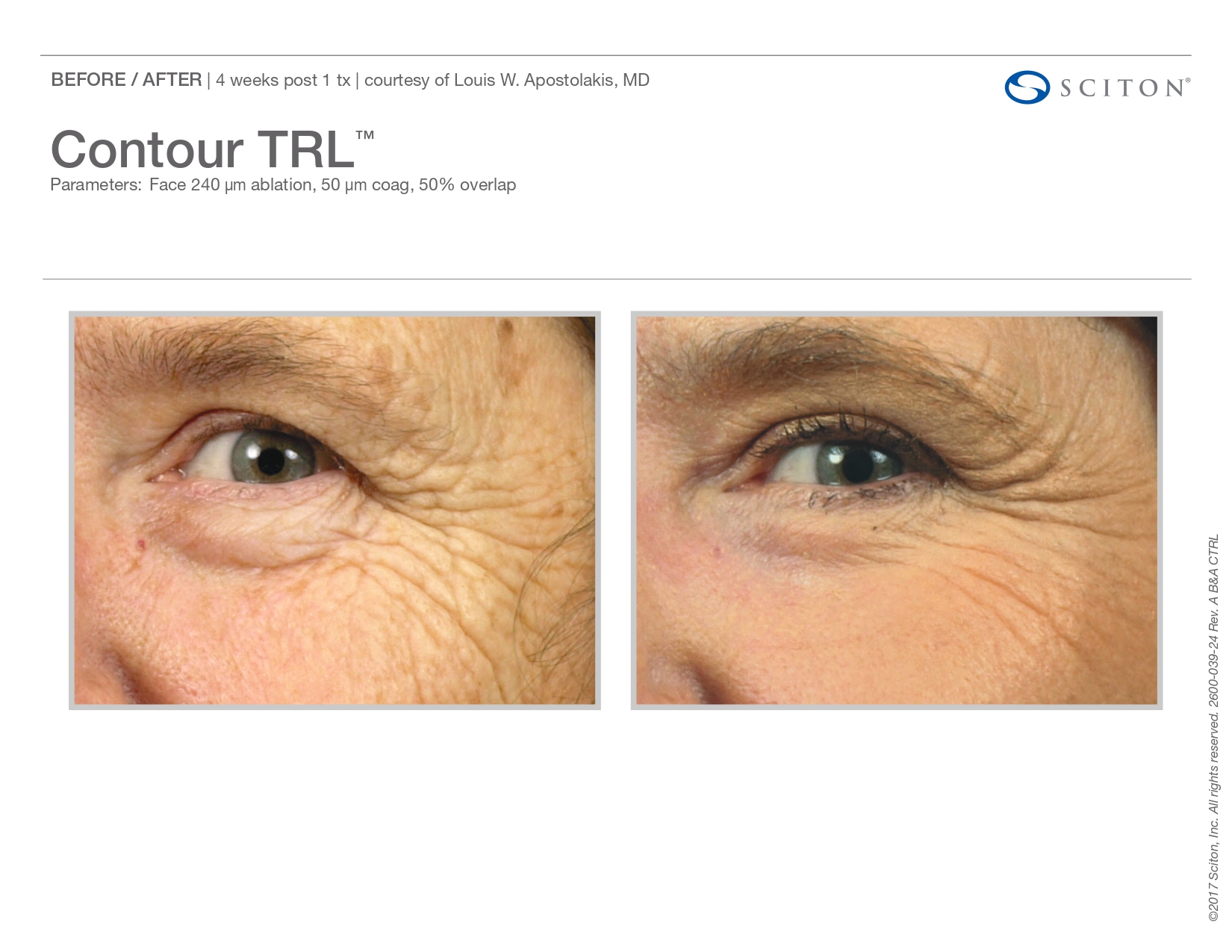 Trubeautybytrevor_Gallery_Image_CONTOUR_TRL_Before_and_After_Three_IN_HENDERSON_NV