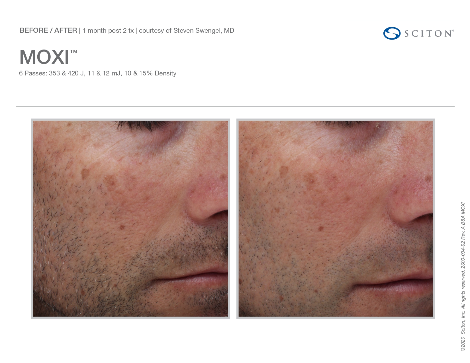 Trubeautybytrevor_Gallery_Image_Moxi_Before_and_After_Six_IN_HENDERSON_NV