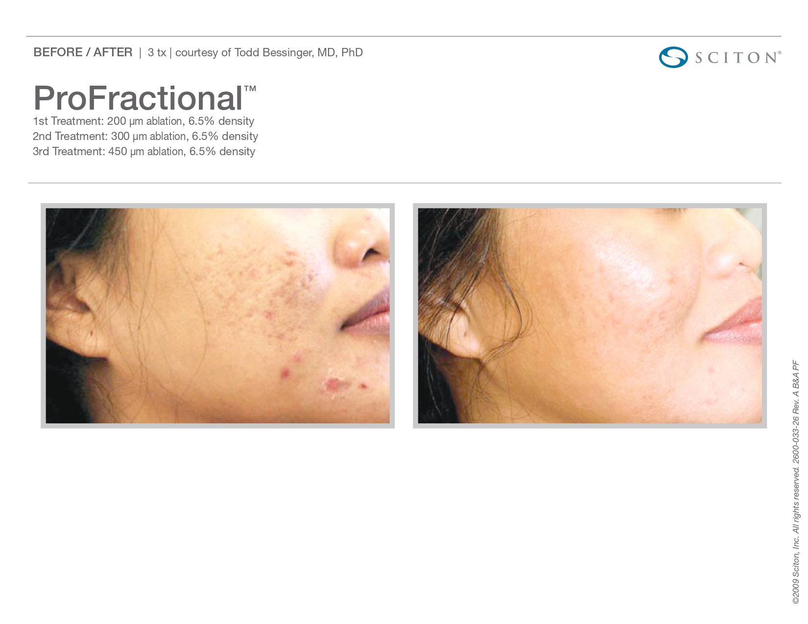 Trubeautybytrevor_Gallery_Image_PROFRACTIONAL_Before_and_After_Eight_IN_HENDERSON_NV