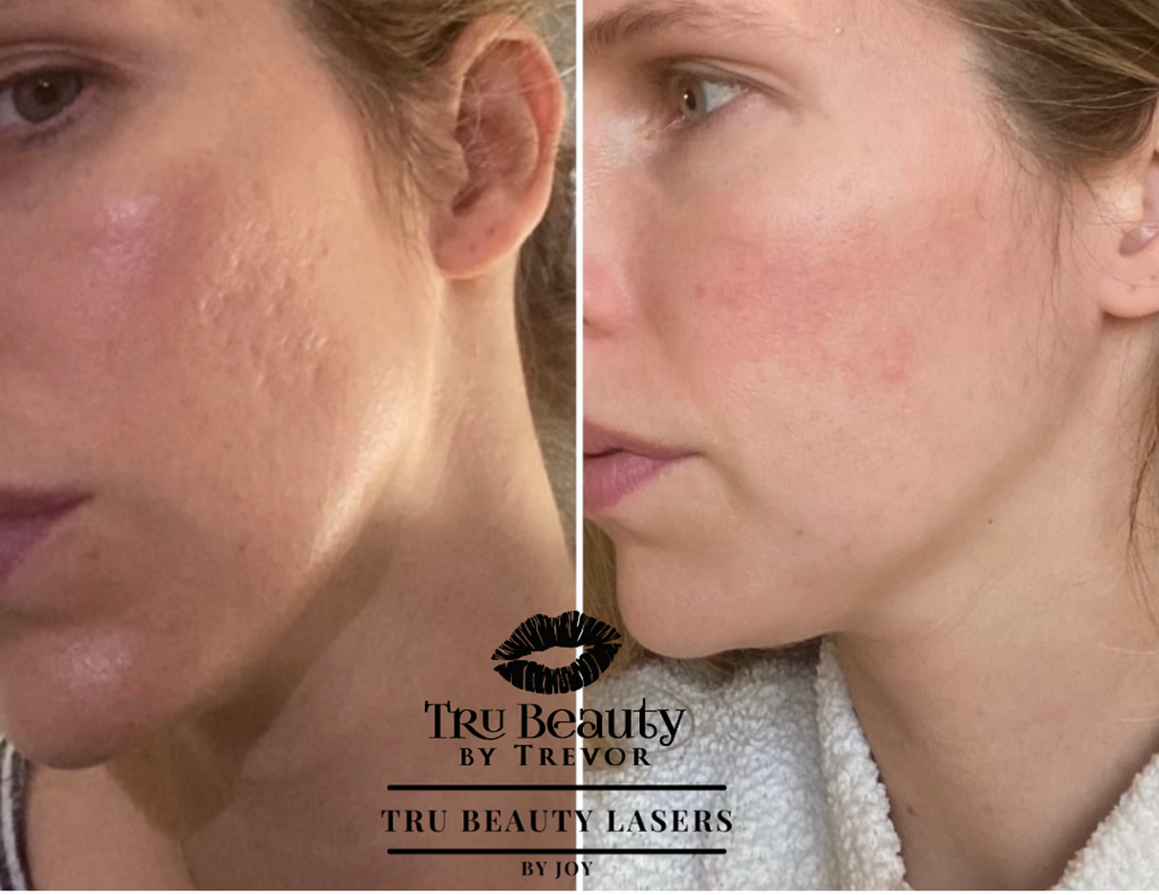 Trubeautybytrevor_Gallery_Image_PROFRACTIONAL_Before_and_After_Eleven_IN_HENDERSON_NV