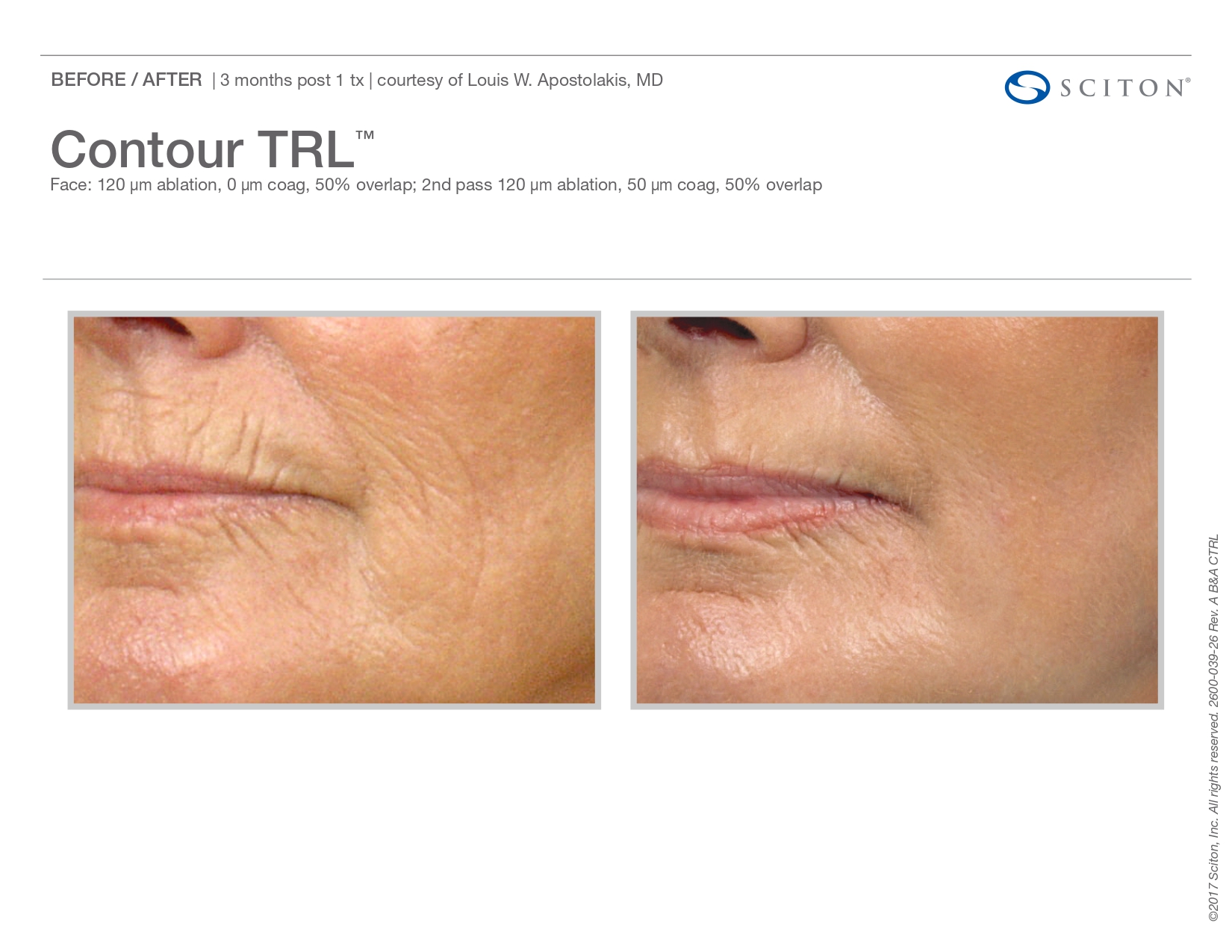 Trubeautybytrevor_Gallery_Img_CONTOUR_TRL_Before_and_After_One_IN_HENDERSON_NV