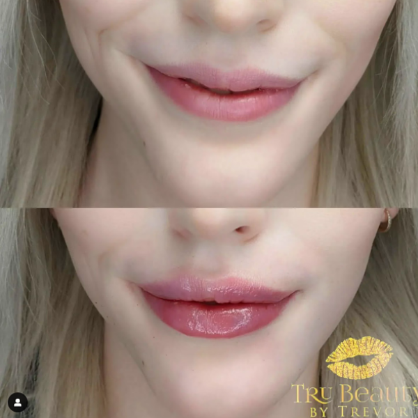 Trubeautybytrevor_Lips_Before_and_After_Gallery_Image_Eight_IN_HENDERSON_NV