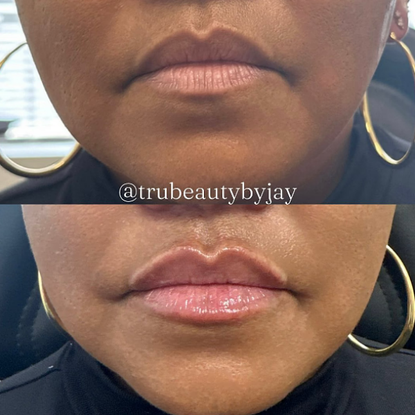 Trubeautybytrevor_Lips_Before_and_After_Gallery_Image_Fifteen_IN_HENDERSON_NV