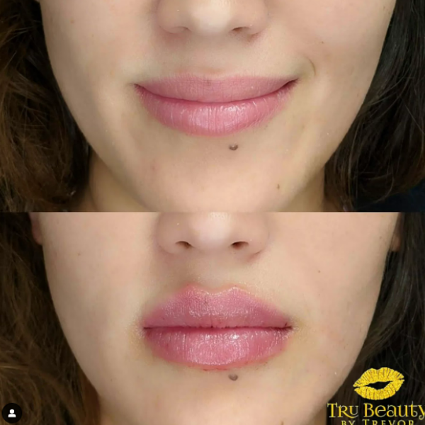 Trubeautybytrevor_Lips_Before_and_After_Gallery_Image_Five_IN_HENDERSON_NV