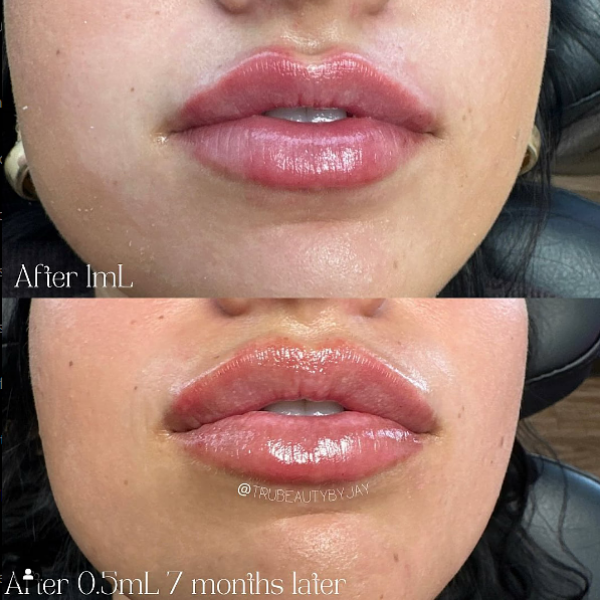Trubeautybytrevor_Lips_Before_and_After_Gallery_Image_Fourteen_IN_HENDERSON_NV