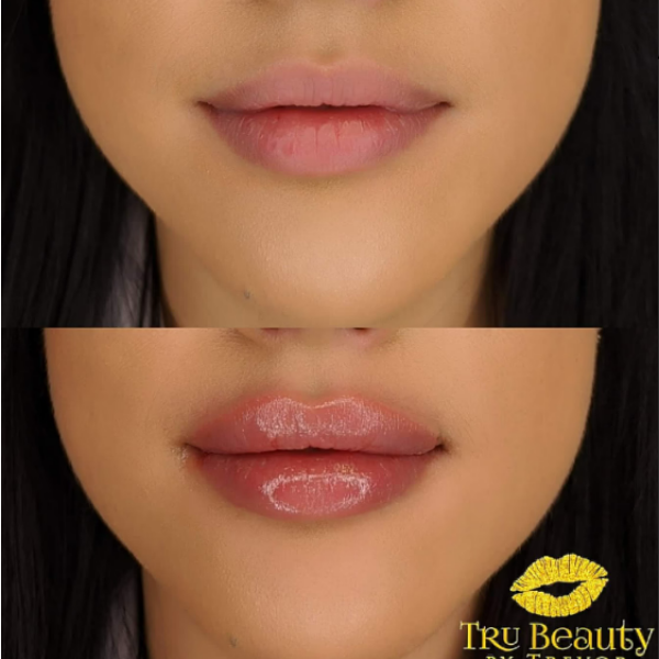 Trubeautybytrevor_Lips_Before_and_After_Gallery_Image_Six_IN_HENDERSON_NV
