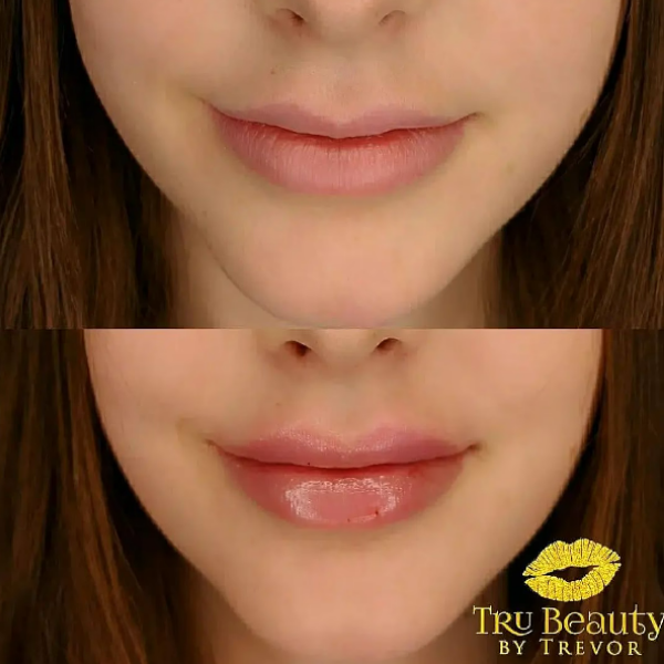 Trubeautybytrevor_Lips_Before_and_After_Gallery_Image_Sixteen_IN_HENDERSON_NV