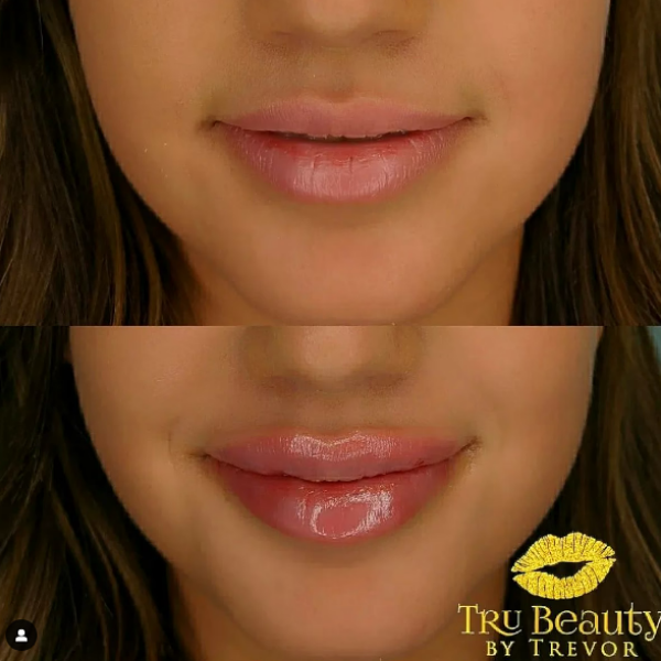 Trubeautybytrevor_Lips_Before_and_After_Gallery_Image_Thirteen_IN_HENDERSON_NV