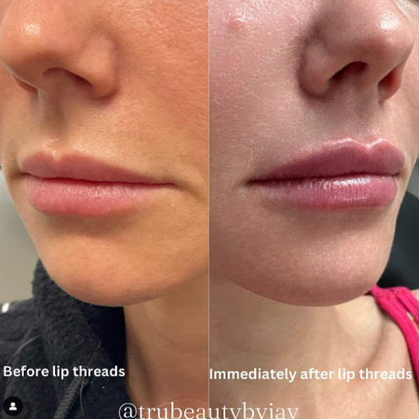 Trubeautybytrevor_Lips_Before_and_After_Gallery_Image_Two_IN_HENDERSON_NV