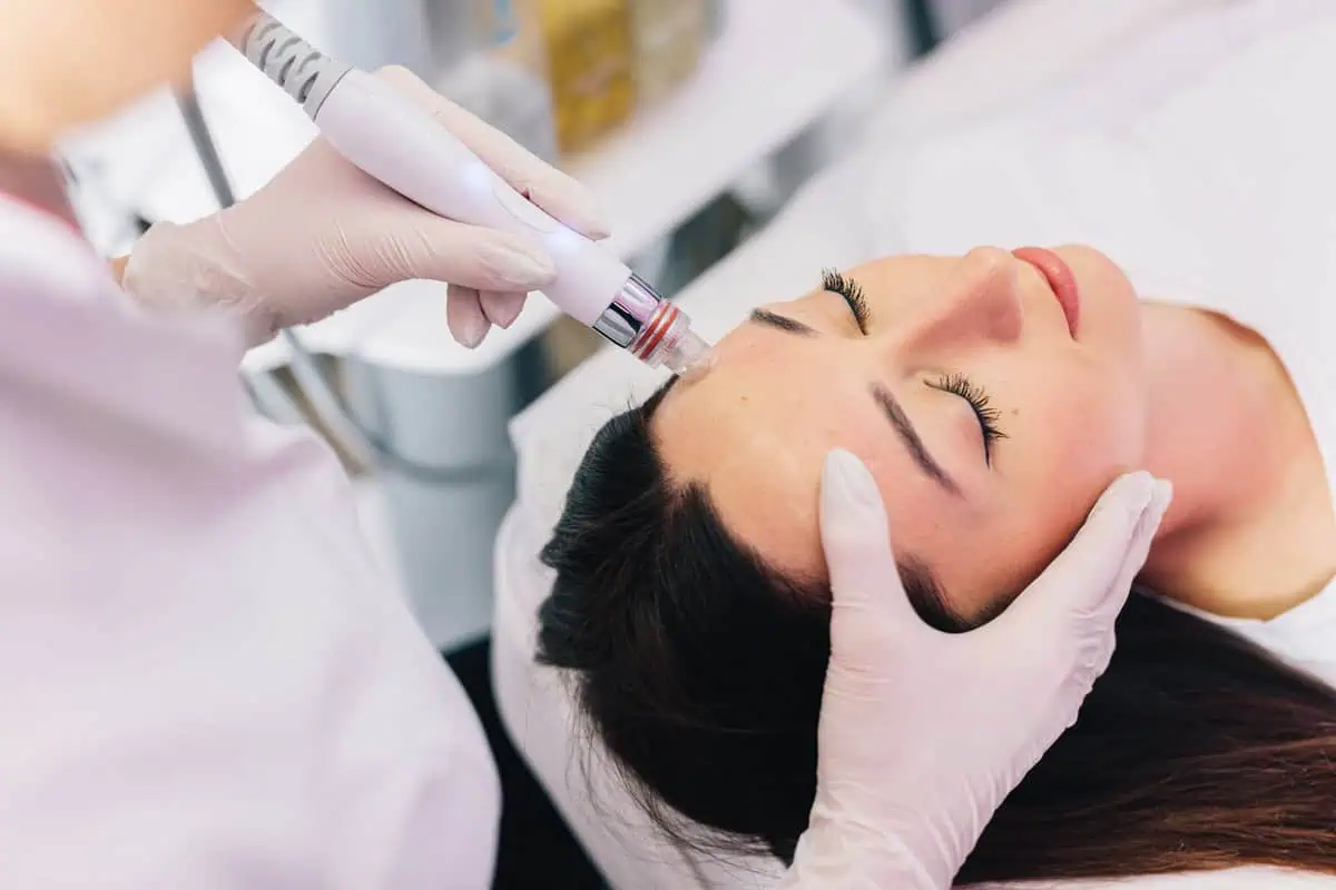 Morpheus8 vs. Traditional Radiofrequency for Skin Tightening Treatment