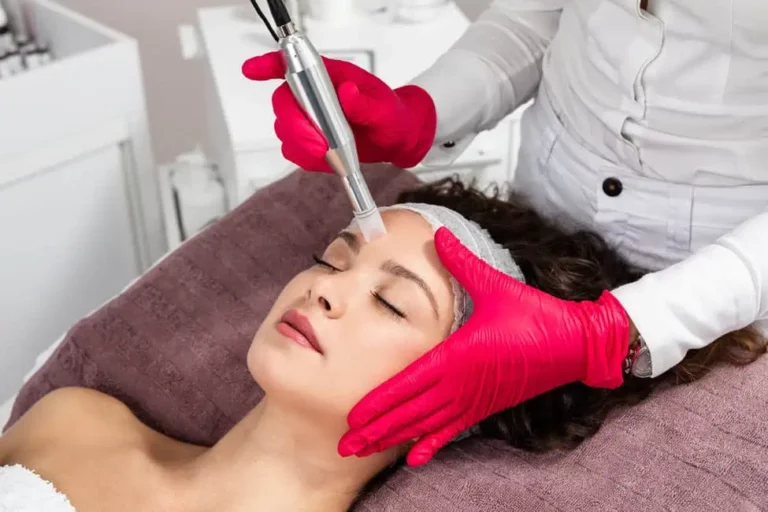Microneedling by Tru Beauty by Trevor in Henderson, NV
