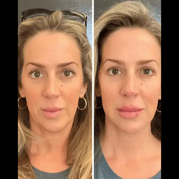 facial balancing 3n.webp