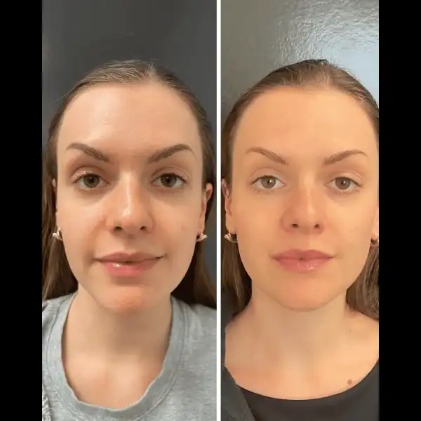 facial balancing 4n.webp