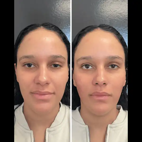 facial balancing 5n.webp