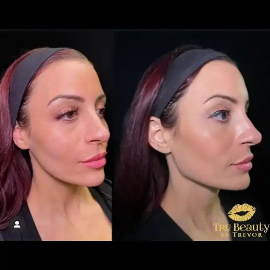jawline new11