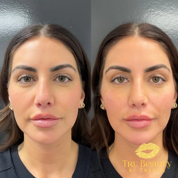 BeforeAfters_2020-1