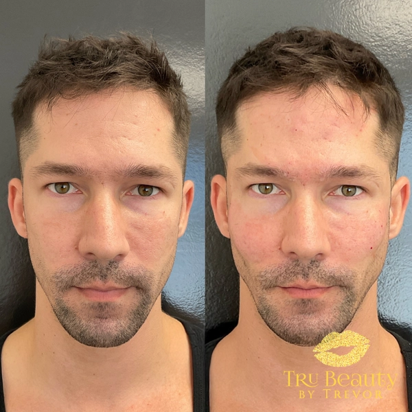 BeforeAfters_2021-1