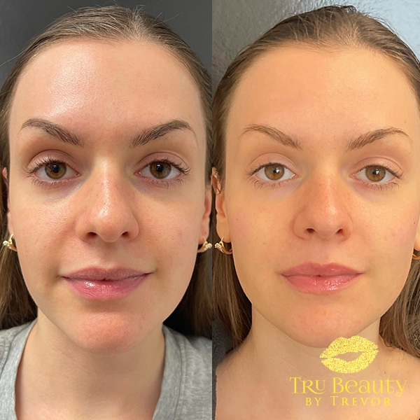 Facial Balancing 2