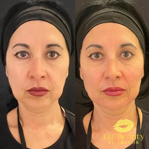 Full face