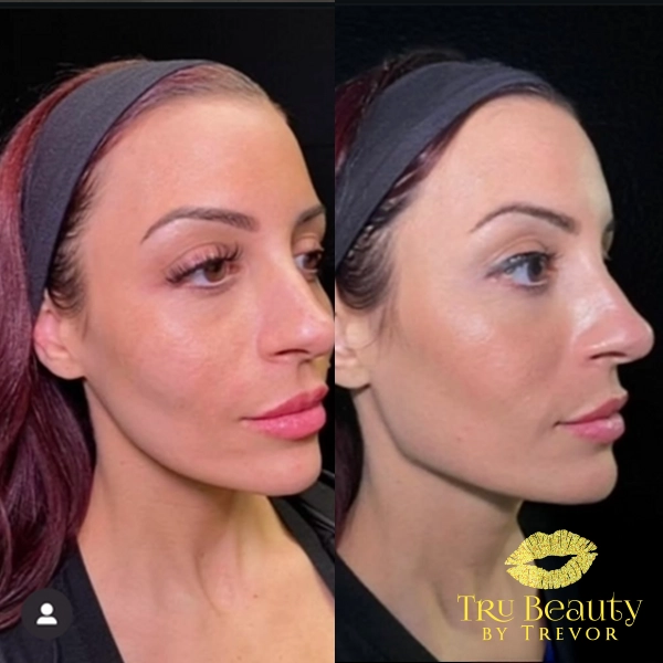 Jawline 2