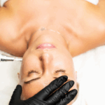Microneedling at Tru Beauty By Trevor in Henderson, NV