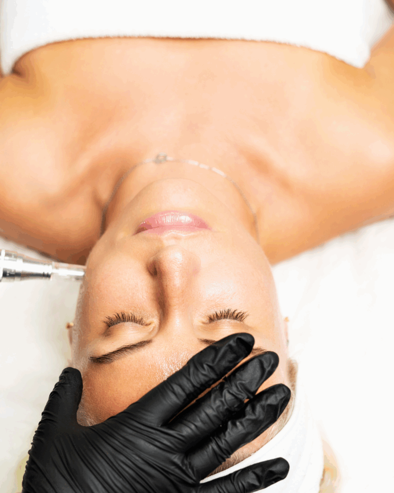 Microneedling at Tru Beauty By Trevor in Henderson, NV