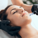 Microneedling at Tru Beauty in Henderson nv