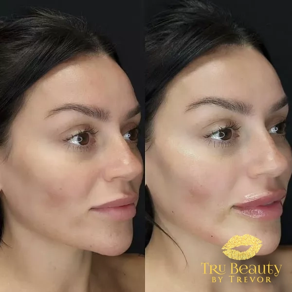 Trubeautybytrevor_Gallery_Image_FULL_FACE_Before_and_After_One_IN_HENDERSON_NV