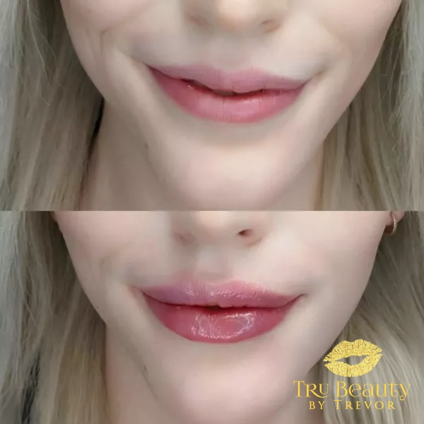 Trubeautybytrevor_Lips_Before_and_After_Gallery_Image_Eight_IN_HENDERSON_NV