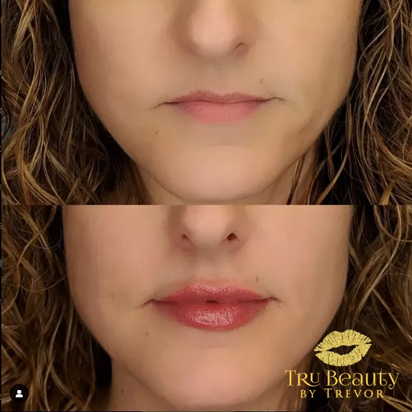 Trubeautybytrevor_Lips_Before_and_After_Gallery_Image_Eighteen_IN_HENDERSON_NV