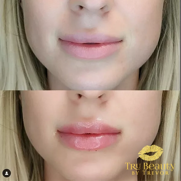 Trubeautybytrevor_Lips_Before_and_After_Gallery_Image_Eleven_IN_HENDERSON_NV