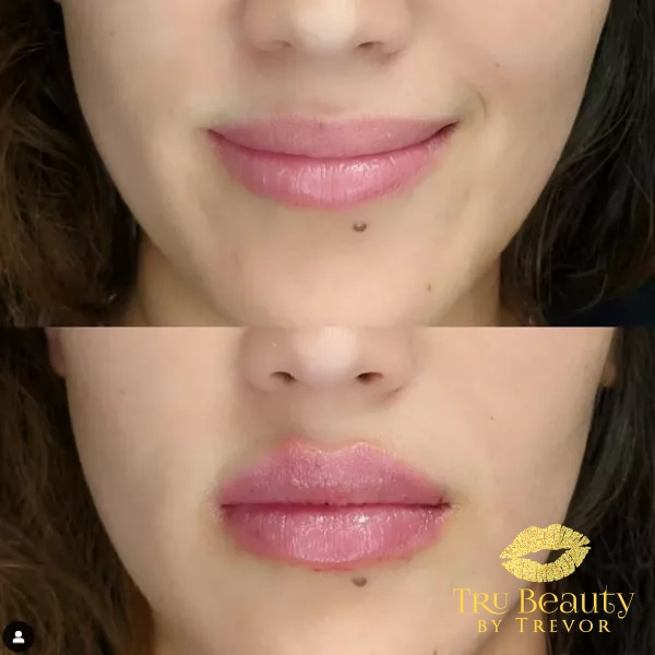 Trubeautybytrevor_Lips_Before_and_After_Gallery_Image_Five_IN_HENDERSON_NV
