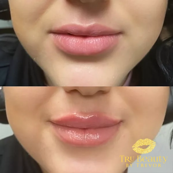 Trubeautybytrevor_Lips_Before_and_After_Gallery_Image_Four_IN_HENDERSON_NV