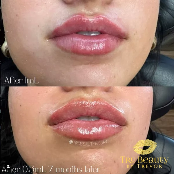 Trubeautybytrevor_Lips_Before_and_After_Gallery_Image_Fourteen_IN_HENDERSON_NV