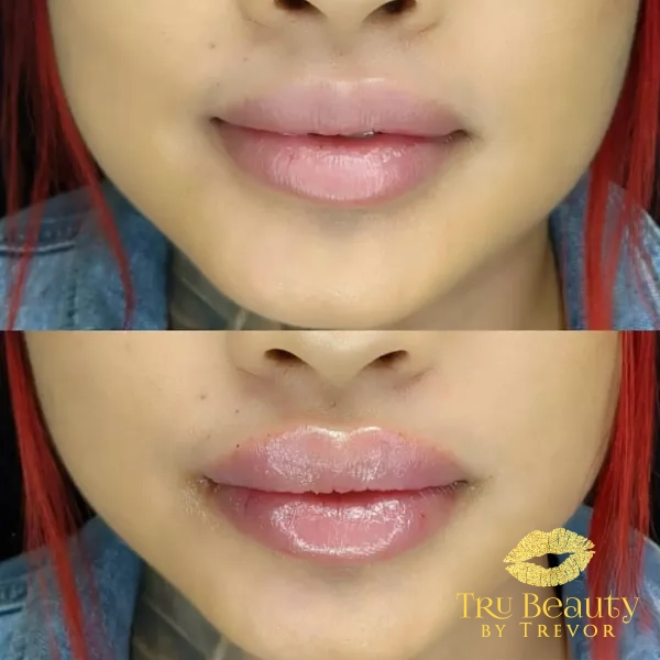 Trubeautybytrevor_Lips_Before_and_After_Gallery_Image_Nine_IN_HENDERSON_NV