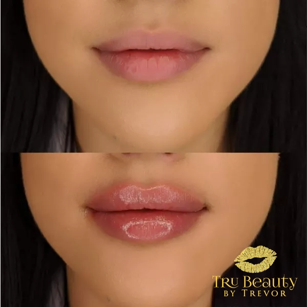 Trubeautybytrevor_Lips_Before_and_After_Gallery_Image_Six_IN_HENDERSON_NV