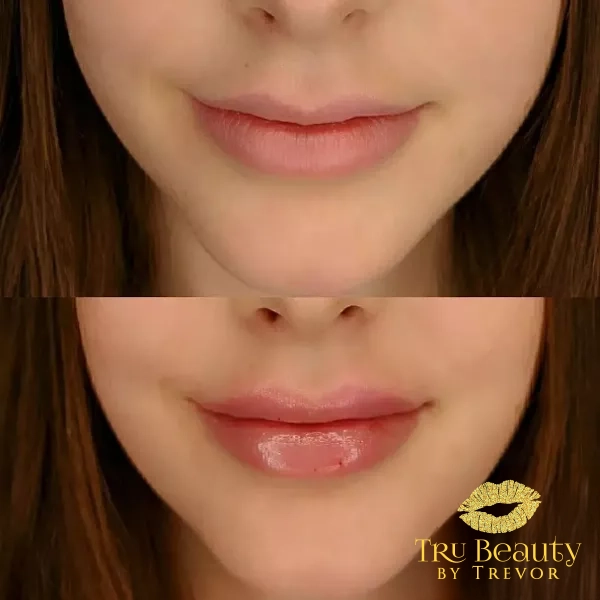 Trubeautybytrevor_Lips_Before_and_After_Gallery_Image_Sixteen_IN_HENDERSON_NV