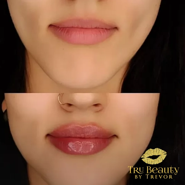 Trubeautybytrevor_Lips_Before_and_After_Gallery_Image_Twelve_IN_HENDERSON_NV