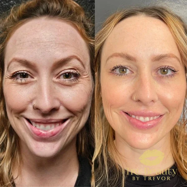 before-and after