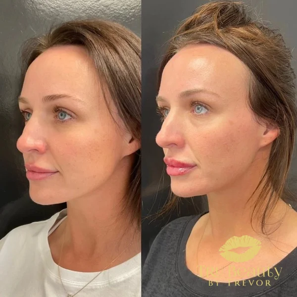 eight-before-after