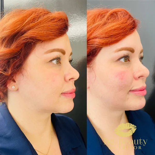 five-before-after
