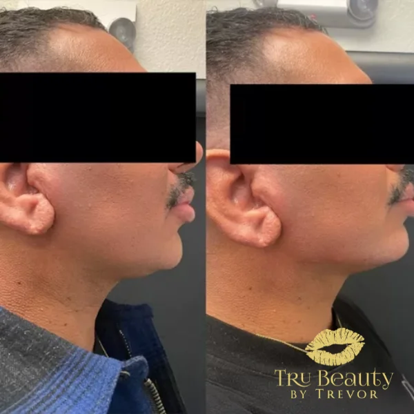 forty-three-before-after